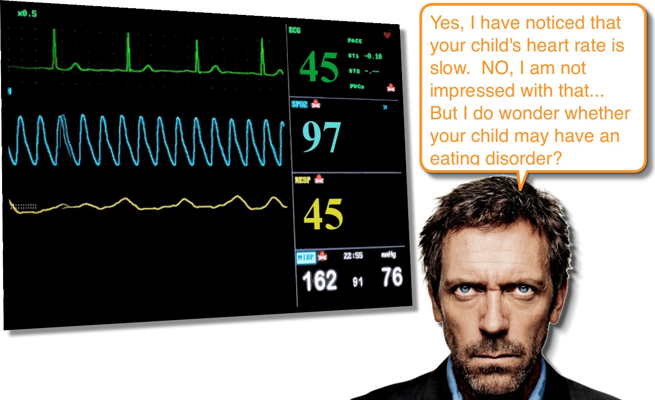 heart rhythm bradycardia