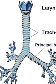 Tracheitis