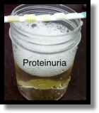 Proteinuria