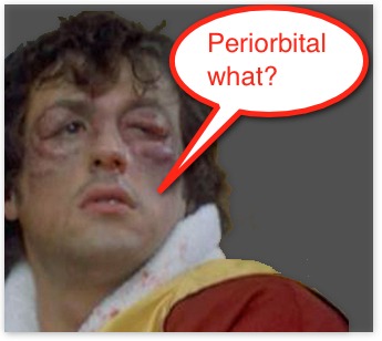 Periorbital