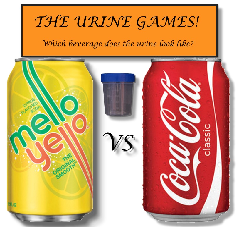 Coca Cola Urine