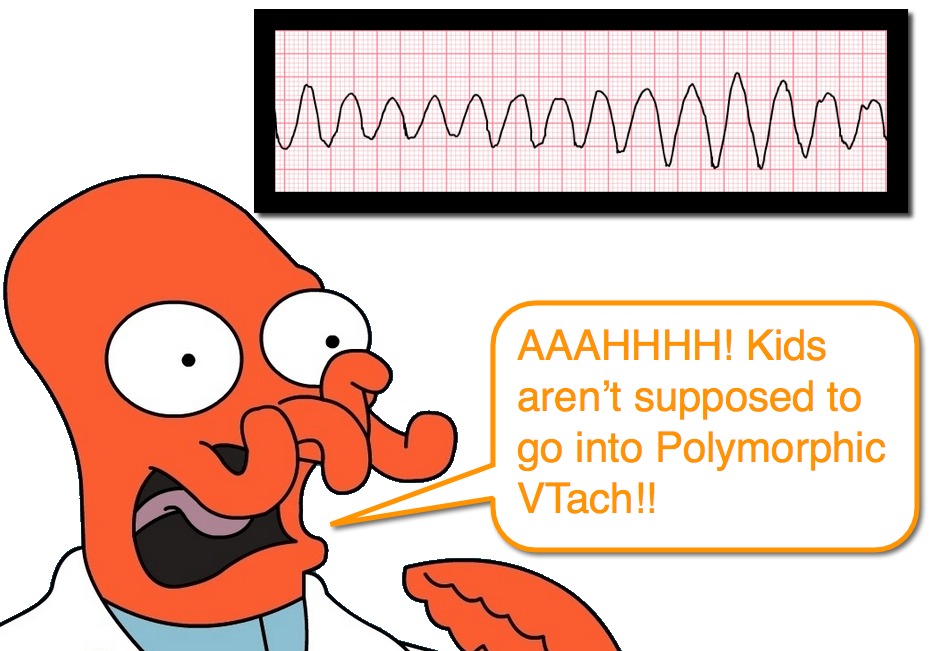 polymorphic ventricular tachycardia