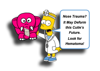 nasal septal hematoma