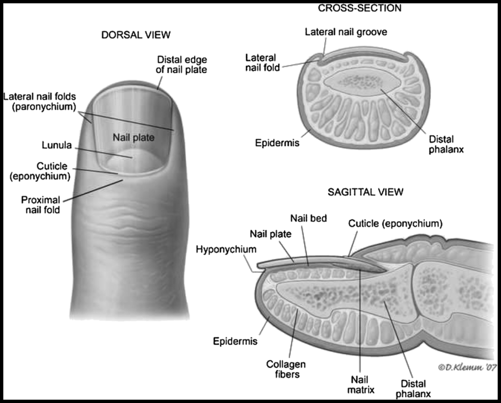 nail-bed-lacerations-pediatric-em-morsels