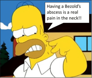 Bezold’s Abscess in Children