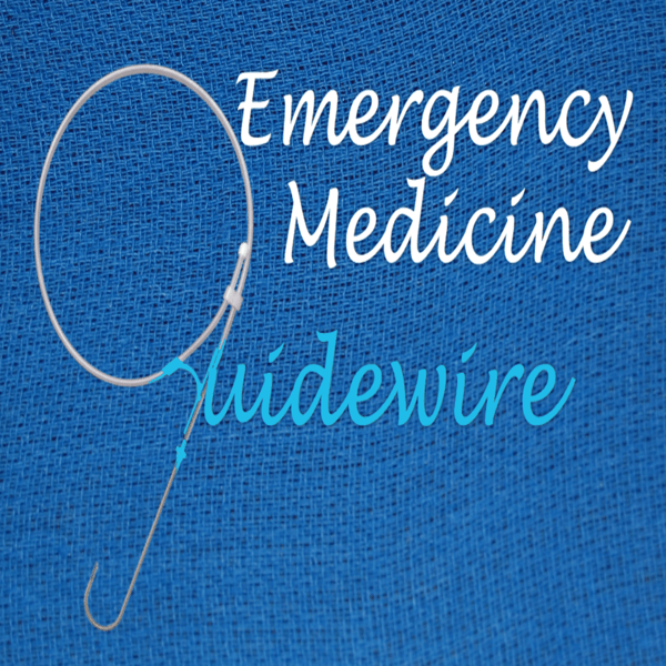 EMGuideWire